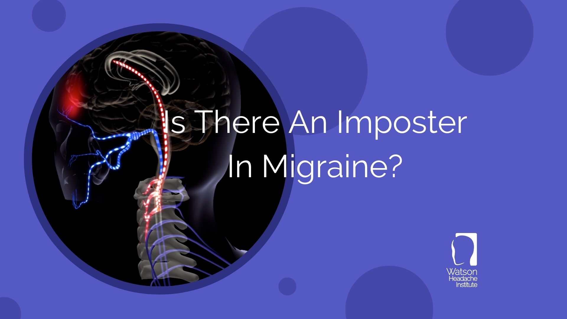 Commentary - Is There An Imposter In Migraine