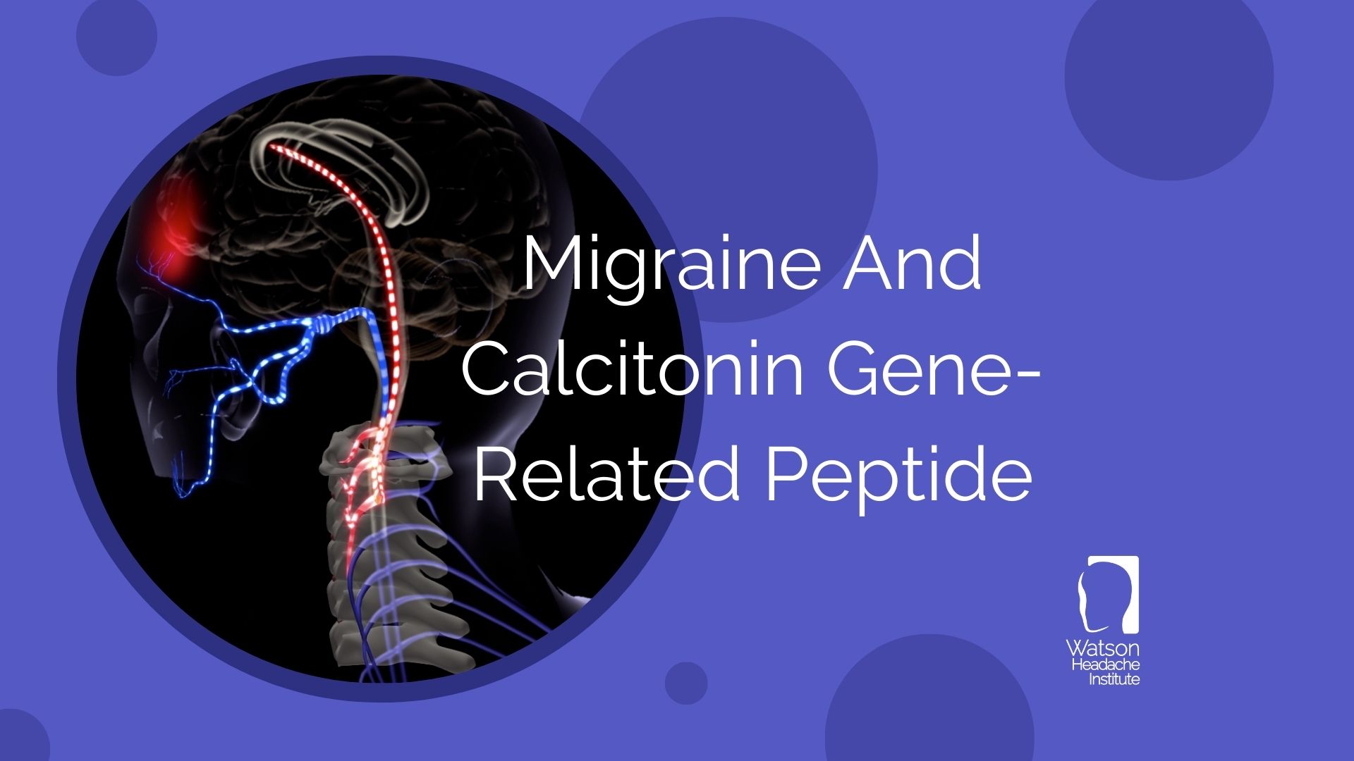 Commentary - Migraine And Calcitonin Gene Related Peptide